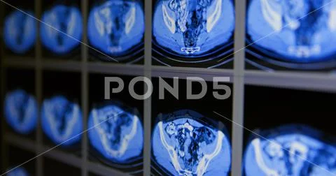 Photograph: CT scans as background texture closeup photo #149871472