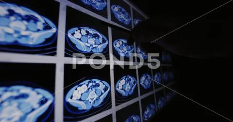 CT scans as background texture closeup photo Stock Photo #149871475