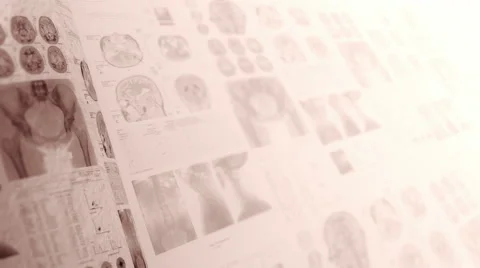 CT scans, X-ray computed tomography. Medical, clinical background in sepia. Stock Footage 61437785