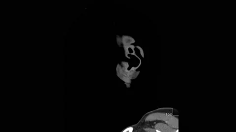 CT Series of Brain, Sagittal View Stock Footage 64822900