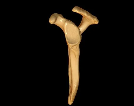 CT Shoulder 3D Stock Illustration