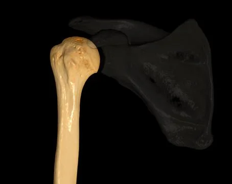 CT Shoulder 3D Stock Illustration