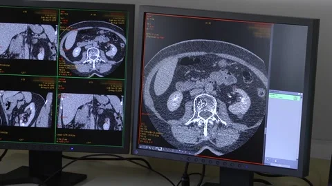 CT X-ray Scan on Human Brain Stock Footage 97849195