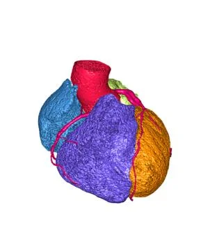CTA Coronary artery 3D rendering image  isolated on white background for dete Stock Illustration