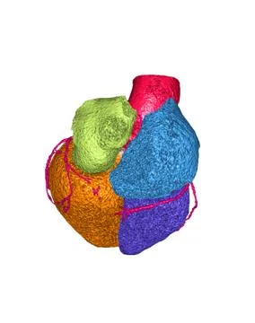 CTA Coronary artery 3D rendering image back view isolated on white background Stock Illustration