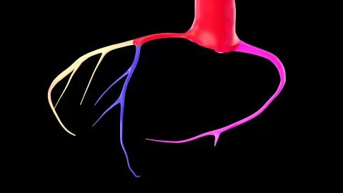 CTA Coronary artery  3D rendering 7.2020 Stock Illustration