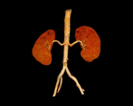 CTA Renal artery  3D rendering image  showing both kidney . Stock-Illustration