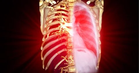 CTA thoracic aorta 3D rendering offers detailed visualization, providing cl.. Stock Illustration
