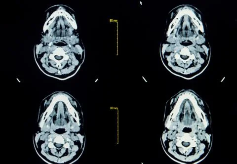Ctscan image Stock Photos