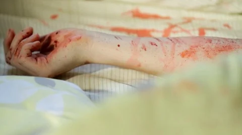 CU Bloody Arm on Bed HD Video Stock-Footage 90956519