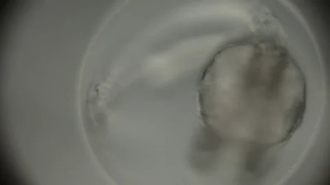 CU Fish Embryo through Microscope focus pulls Stock Footage 78542130