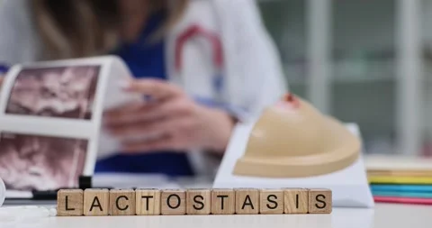 Cubes spell Lactostasis in scene with breast anatomy model Stock Footage 313294005