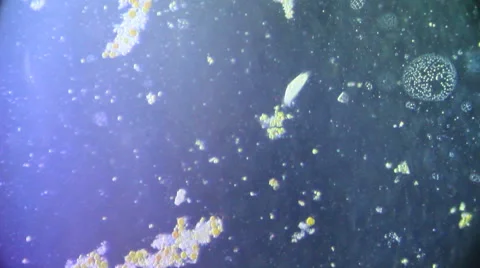 Cultivation. Different bacterial colonies 動画素材 59750405
