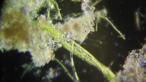 Cultivation. Different bacterial colonies Stock Footage 71453315