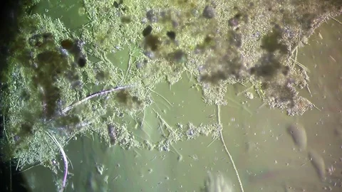 Cultivation. Different bacterial colonies Stock Footage 72715737