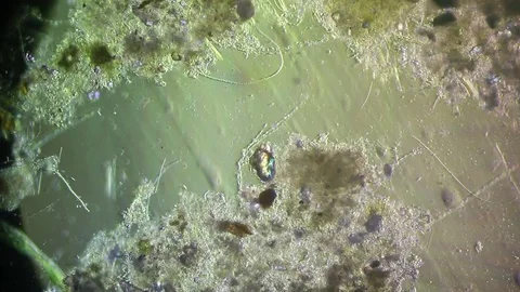 Cultivation. Different bacterial colonies Stock Footage 72715740