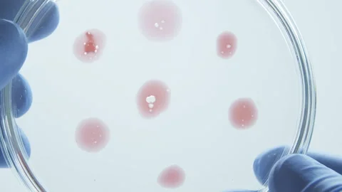 Culture medium plate.  Stock-Footage 242806711