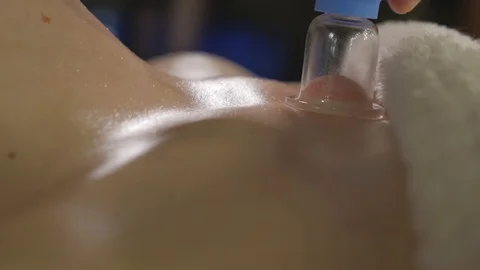 Cupping massage of the chest part of the woman's body Stock Footage 118971081