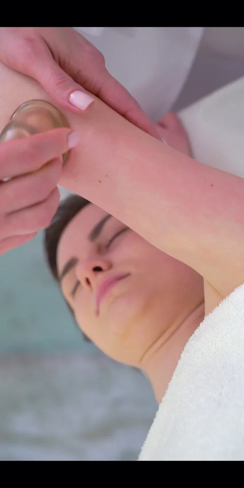 Cupping Massage Therapy on Arm for Relaxation and Recovery Stock Footage 319346158