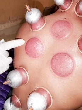 Cupping Stock Photos