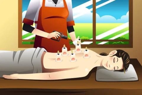 Cupping Therapy Stock Illustration