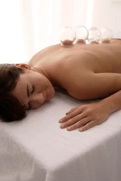 Cupping treatment down woman's back Stock Photos