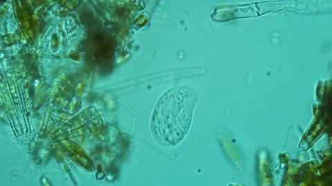 A curious single-celled microbe is exploring a new habitat. Hunt and fight Stock Footage 167913360