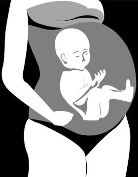 Current pregnancy Stock Illustration