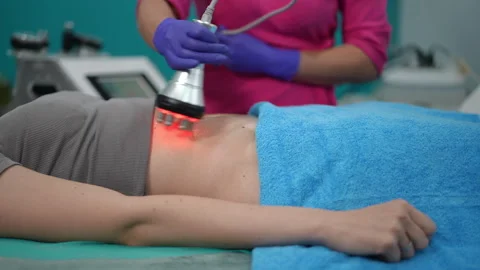 Currently, we are in the process of a Non Surgical Body Contouring Treatment Stock Footage 311364780