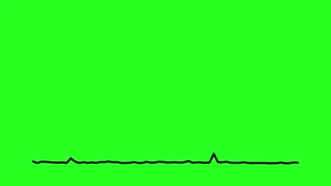 Curve A Down Audio Spectrum Green Screen Background Stock-Footage 303390443