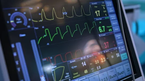 Curved diverse lines and parameters are displayed on the dark monitor.  Video stock 274096180