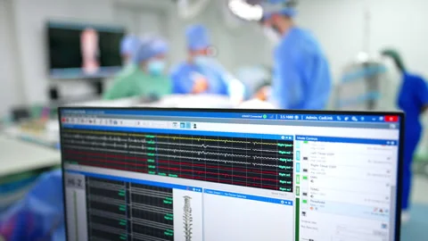 Curved lines run at the computer screen. Team of doctors work at the operating Stock Footage 331081572