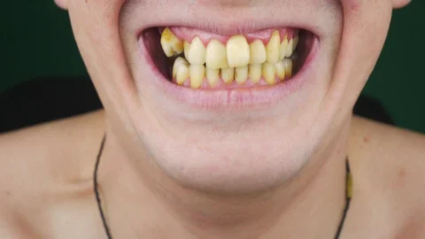 Curves yellow teeth close up. Stock-Footage 127588801
