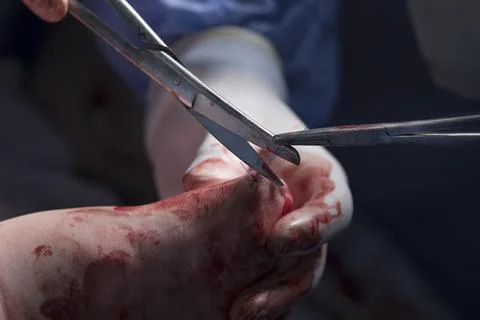 Cut The Final Stitch Stockfoto's