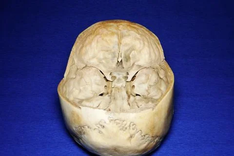 Cut skull on blue background Stock Photos