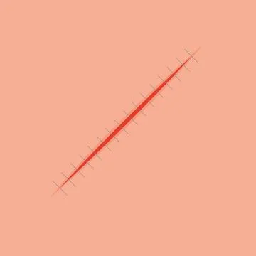Cut suture scar vector icon. First aid injury stitch skin concept wound Illustrazione stock