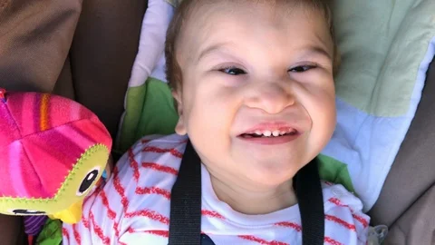 Cute baby with disability close-up in a push chair looking at the camera Video stock 117832484
