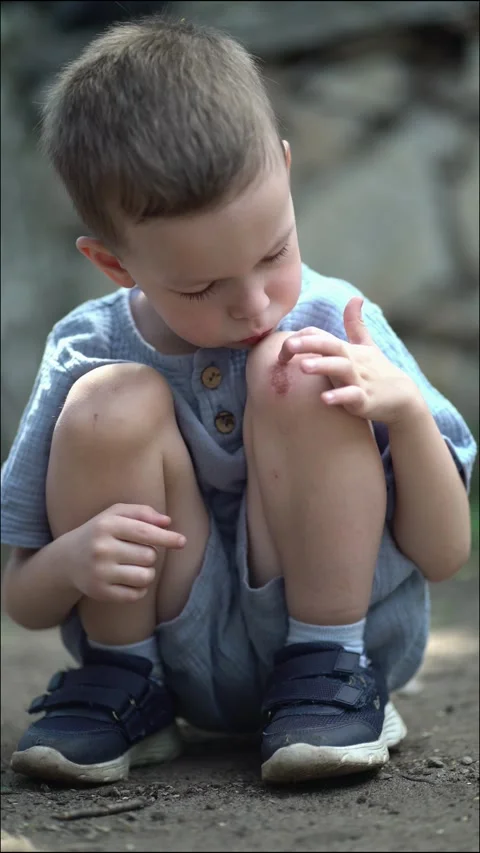 A cute child examines his knee wound outdoors by blowing  Stock-Footage 338417102