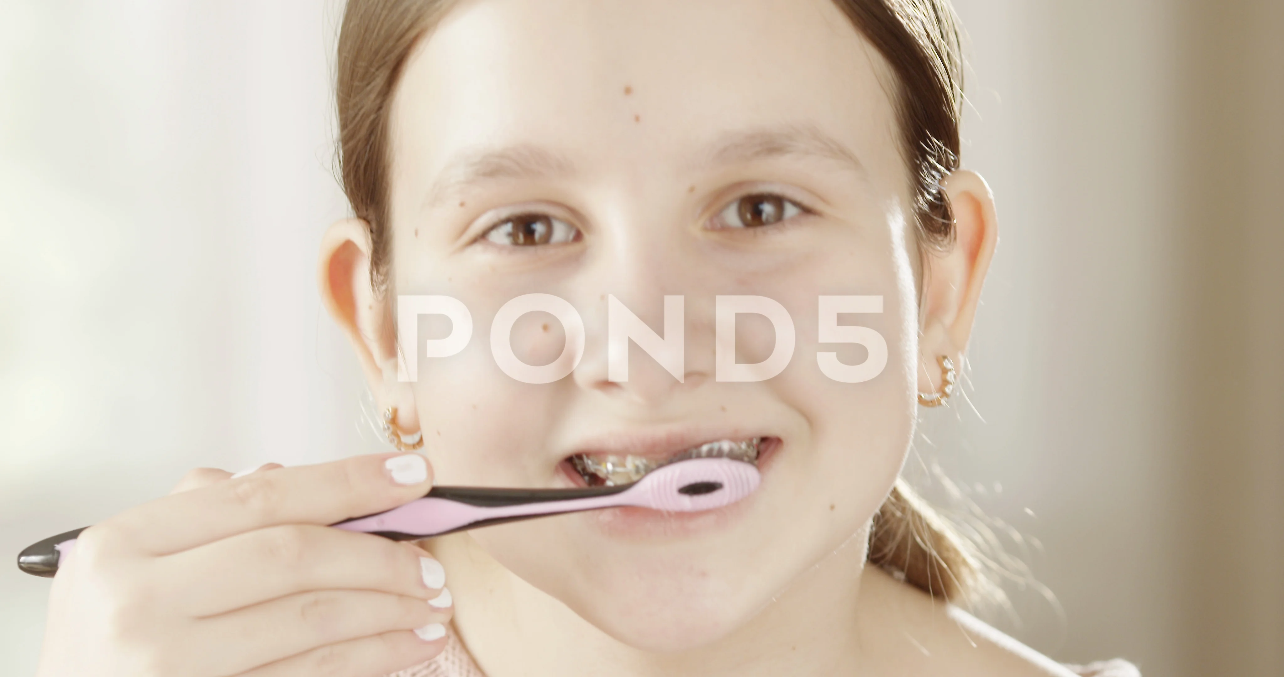 Cute Girl Braces For Teeth Cute Girl Braces For Teeth