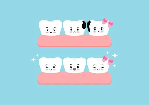 Cute teeth before and after decay in gym dental kids icon set isolated. Stock Illustration
