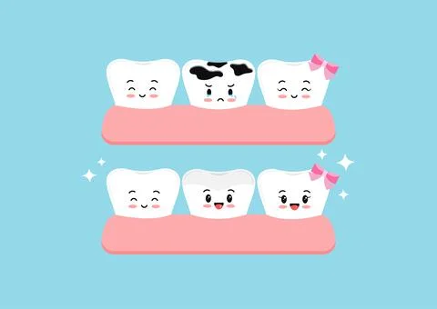 Cute teeth before and after multiple caries in gym dental characters. Stock Illustration