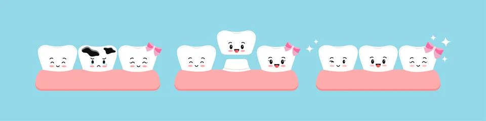 Cute teeth multiple caries, crown stage in gym before and after dental character Stockillustratie