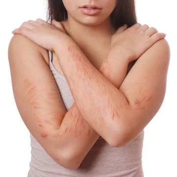 Cuts and scars from self harm Stock Photos