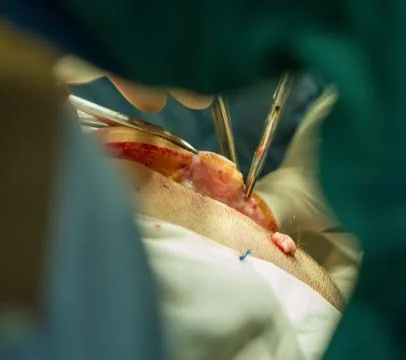 Cutting of the scalp. Stock Photos