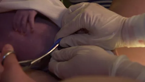 Cutting the umbilical cord Stock Footage 275675452