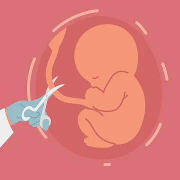 Cutting the umbilical cord Stock Illustration