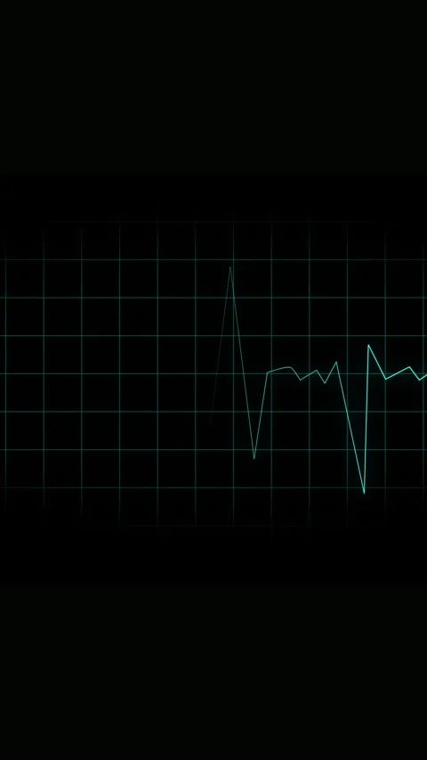 Cyan Heartbeat Line on a Dark Grid Background with Glowing Dot cardiogram pul Stock Footage 337459544