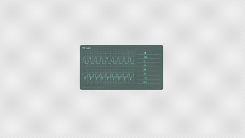 Cyan Medical Ventilator HUD Interface Element Stock Footage 334690286