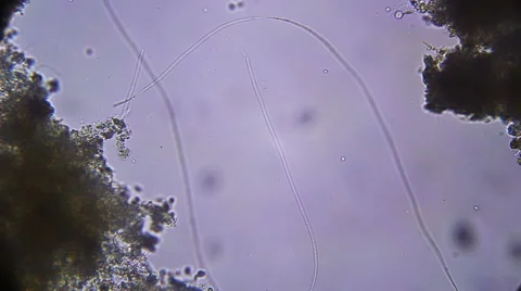 Cyanobacteria SP. microscopic Stock Footage 60700529