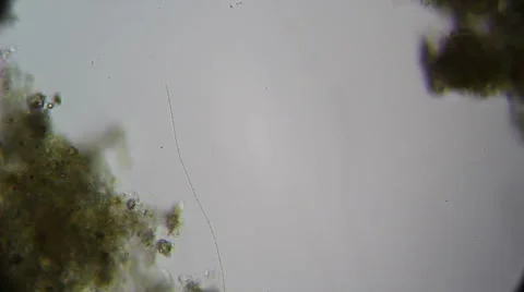 Cyanobacteria SP.microscopic Stock Footage 60700450